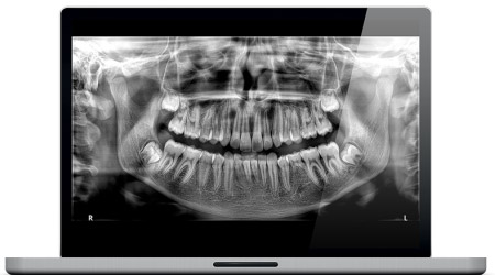 Imágenes Panorámicas CBTC